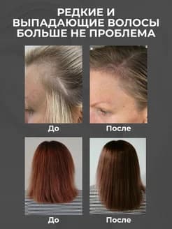 Масло для роста волос - изображение 2