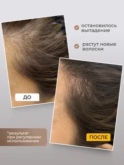 Масло для роста волос - изображение 4